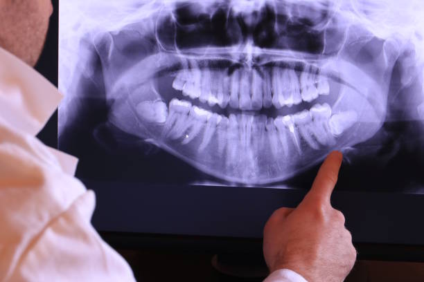 Best Emergency Cosmetic Dentistry (e.g., broken veneers) in Caldwell, NJ